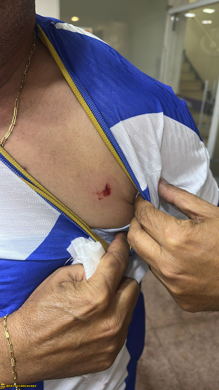 Prefeito de Patos de Minas repudia ação da PM em clássico entre Mamoré e URT: “Inadmissível transformar lazer em pânico”